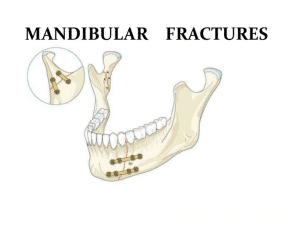 image of mandibular fractures